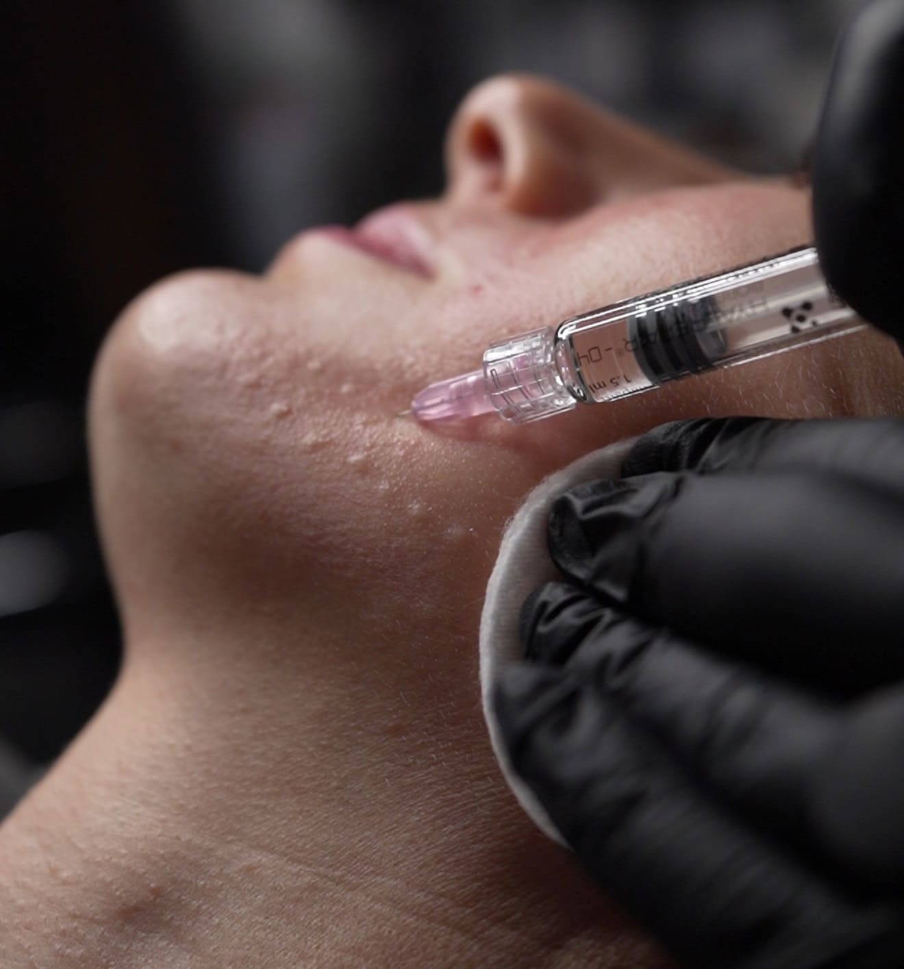 Кому показана мезотерапия?