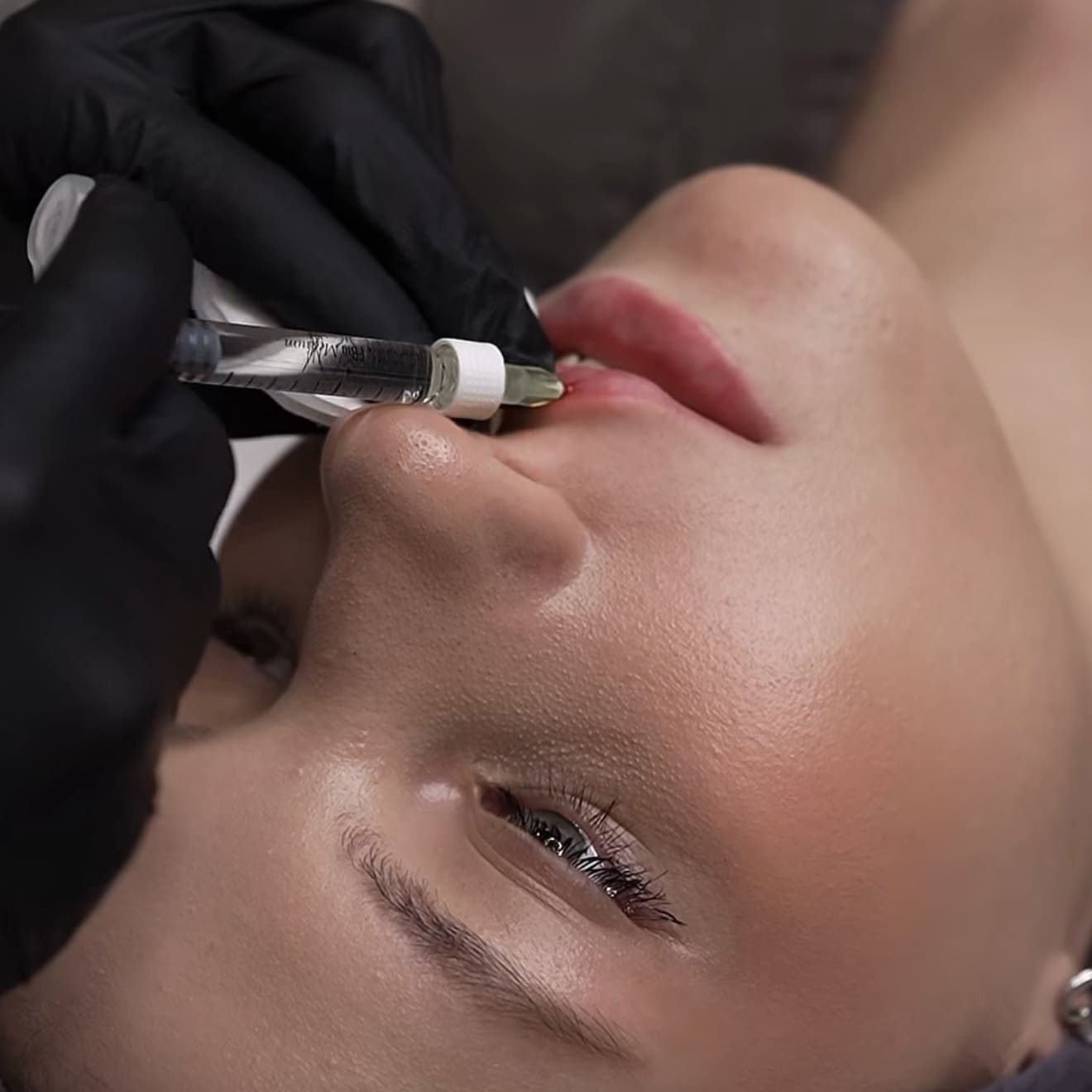 Видно ли, что губы увеличены? Признаки неестественного результата