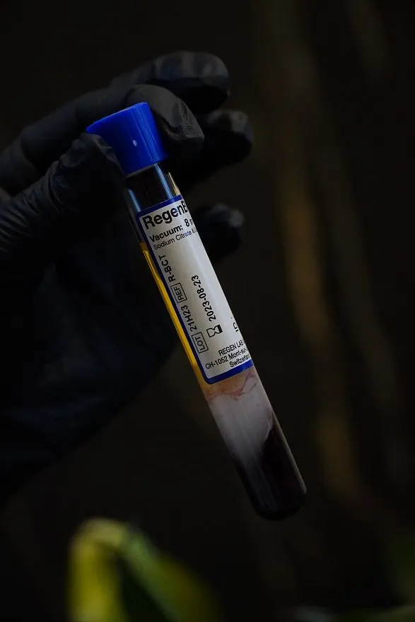 Услуги: плазмотерапия