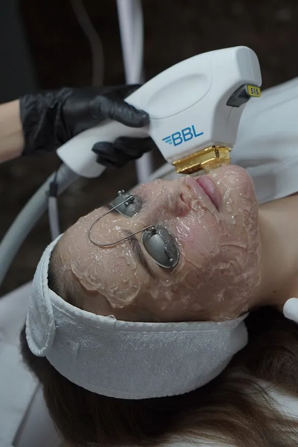 Услуги: фотоомоложение bbl