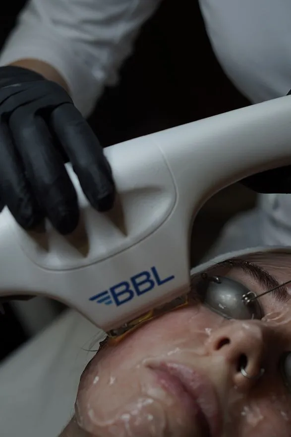 Услуги: skintyte ii