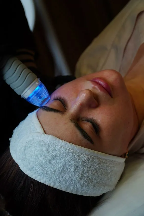 Услуги: vivace (rf-лифтинг)