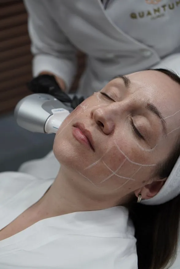 Услуги: ultraformer iii (smas - лифтинг)