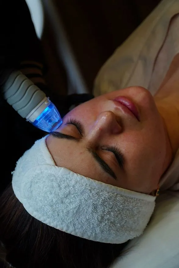 Услуги: vivace (rf-лифтинг)