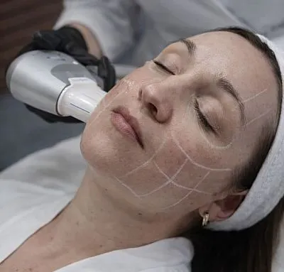 Аппаратные методы омоложения после 30, 40 и 50 лет — полный гид