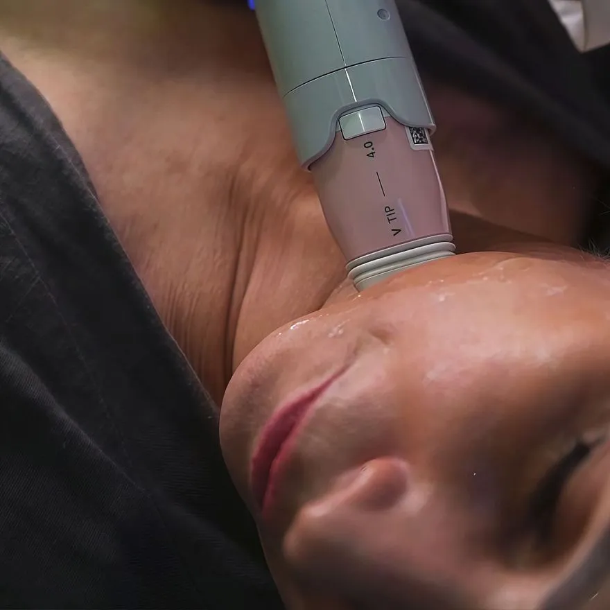 Услуги: монополярный rf-лифтинг volnewmer