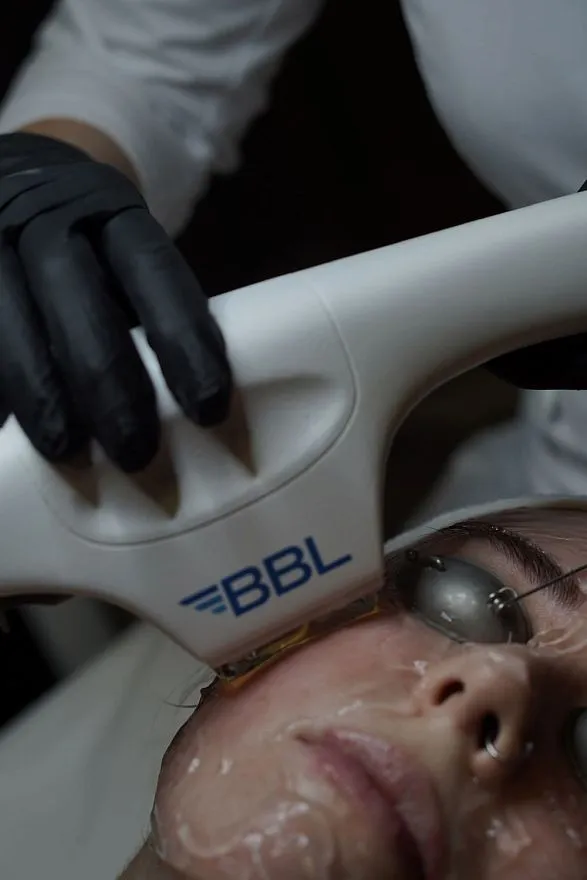 Услуги: skintyte ii