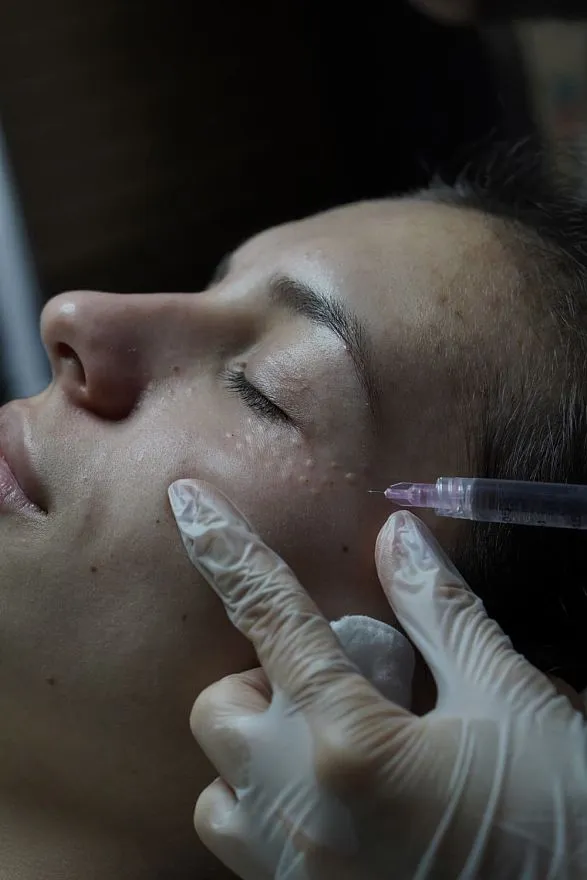 Услуги: биоревитализация