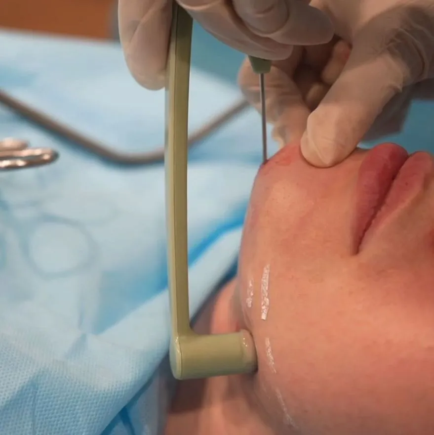 Услуги: facetite