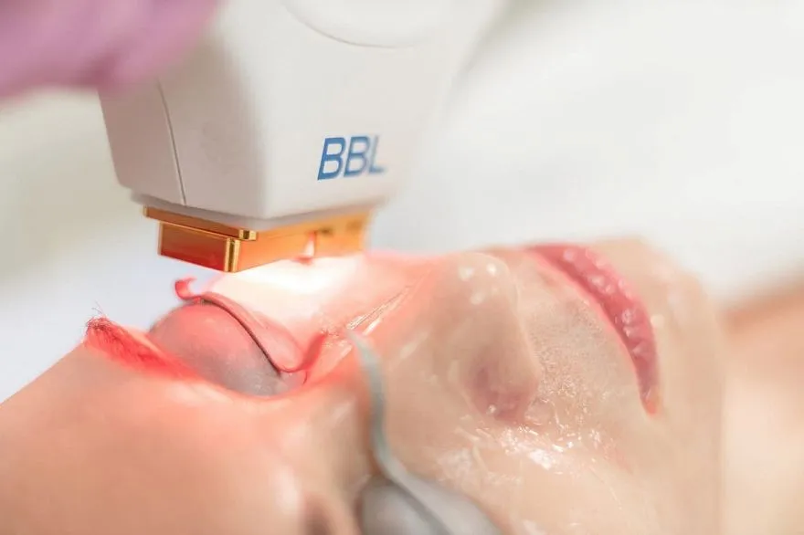 Услуги: bbl hero