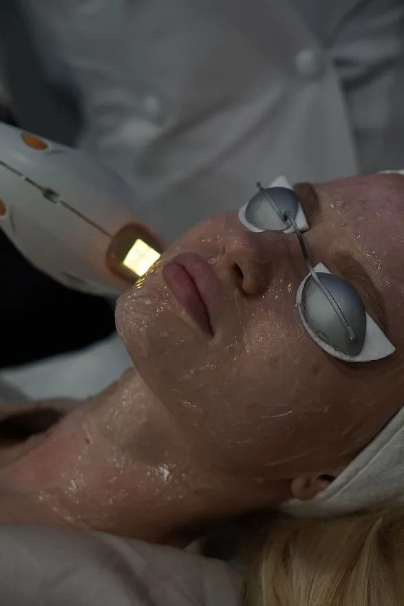 Услуги: фотолечение пигментных пятен