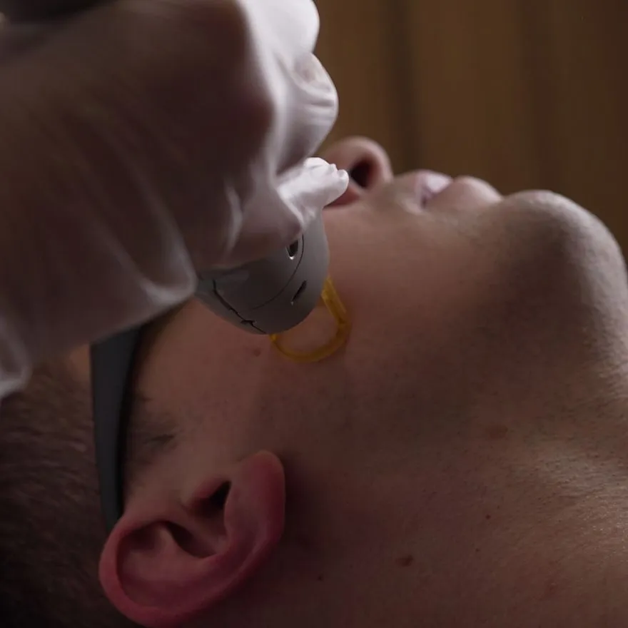 Услуги: лазерная эпиляция на александритовом лазере