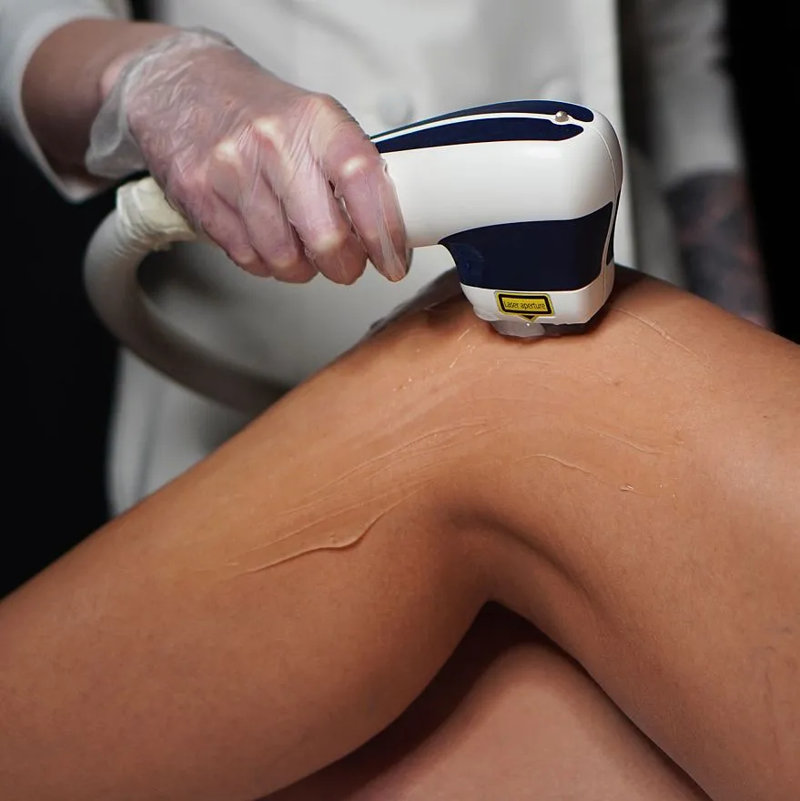 Услуги: лазерная эпиляция на диодном лазере