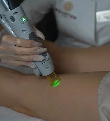 Гирсутизм у женщин: причины и эстетические способы решения проблемы