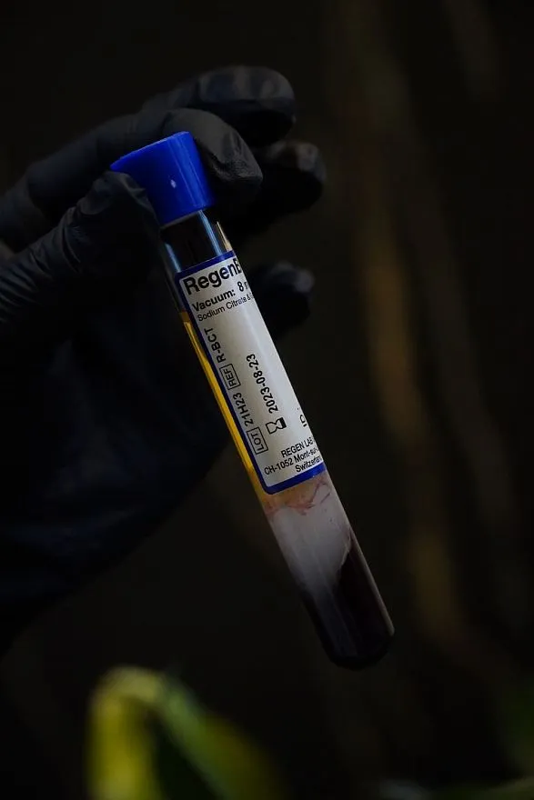 Услуги: плазмотерапия