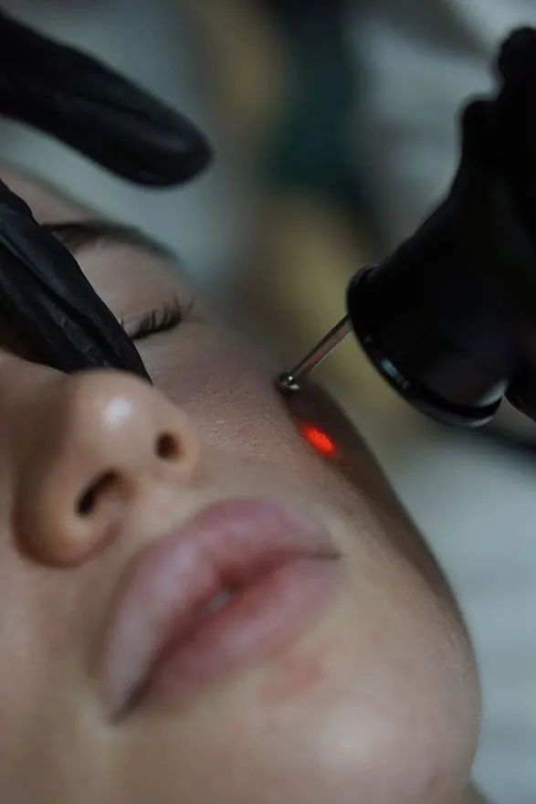 Услуги: dermablate mcl31 (лазерная шлифовка)